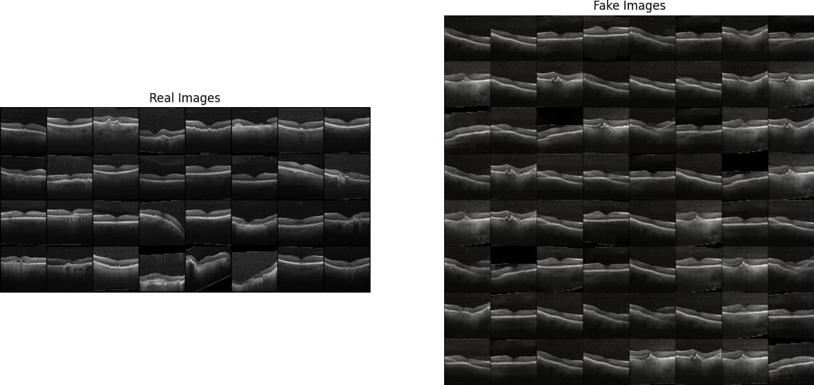 A grid of real OCT eye scans next to a larger grid of generated scans
